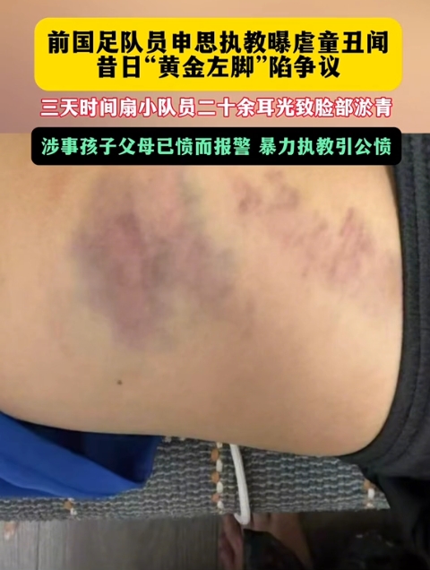 前国脚申思训练中掌掴小球员 家长已报警